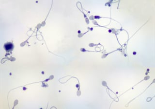 semen analysis test