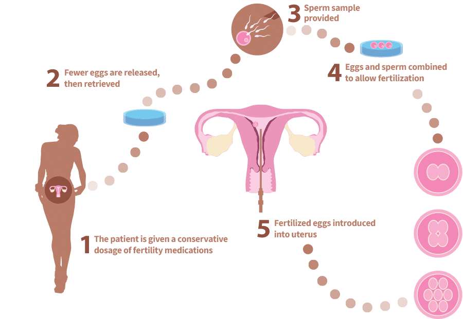 how mini IVF works - graphic